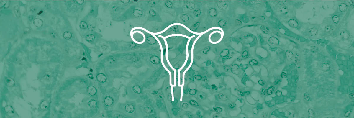 How Myo- and D-Chiro Inositol Play a Role in PCOS Support