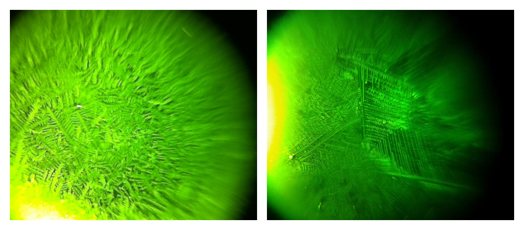 Micro Ferning Ferning Patterns on A Saliva Ovulation Microscope – Fairhaven Health