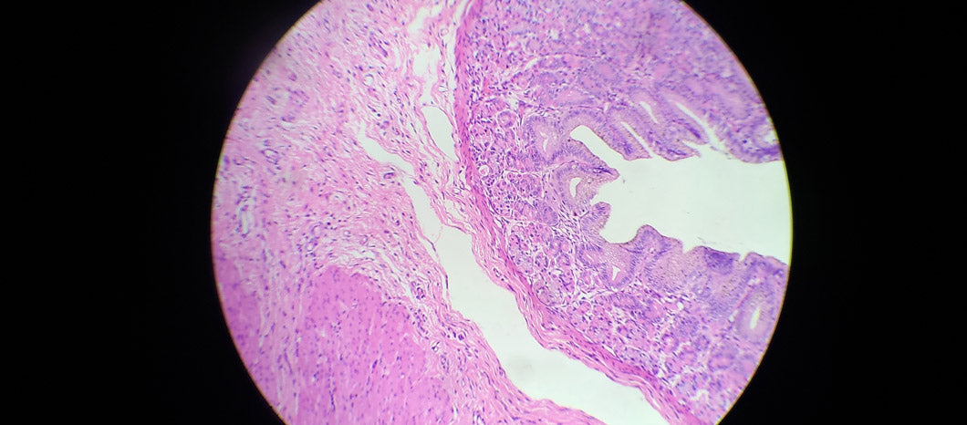 histological section uterus luteal phase